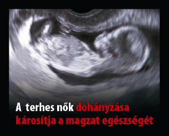 Hungary 2012 ETS baby - internal image of baby, targets pregnant women